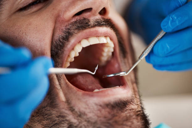 Best Invisalign and Clear Aligners  in Kearney Park, MS